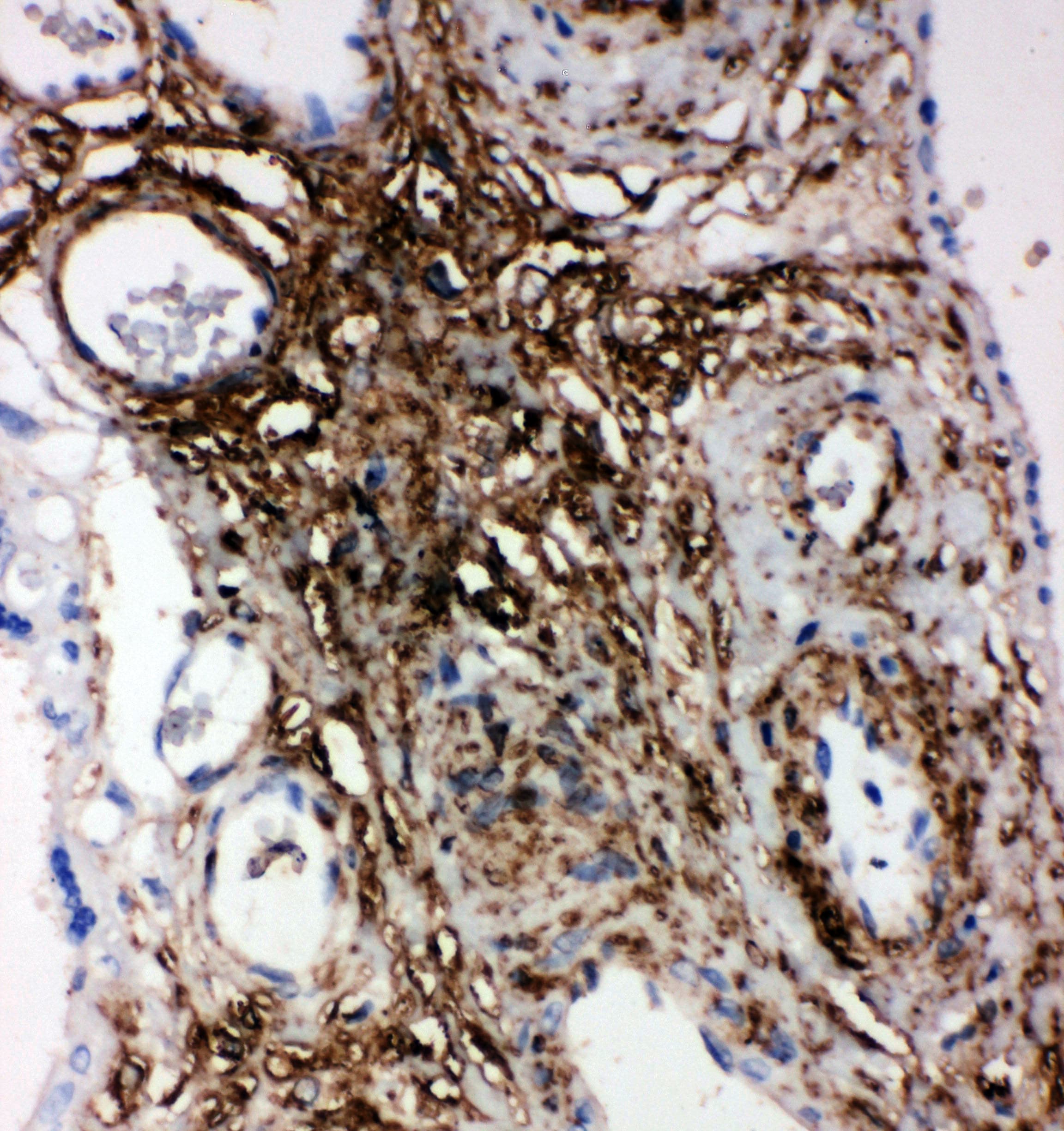 PLTP Antibody (aa256-271)