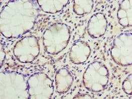 SUMO4 Antibody (aa1-95)