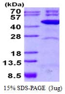 Human TFB2M Protein (Recombinant His)