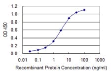 CAST / Calpastatin Antibody (clone 2C5)