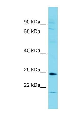 LRRC38 Antibody (C-Terminus)