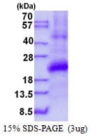 Human IFI30 / IP30 Protein (Recombinant His)