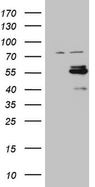CSNK1G1 / CKI-Gamma 1 Antibody (aa163-422, clone OTI4C4)