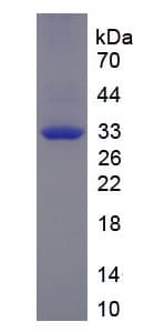 Human MYH3 Protein (Recombinant His)