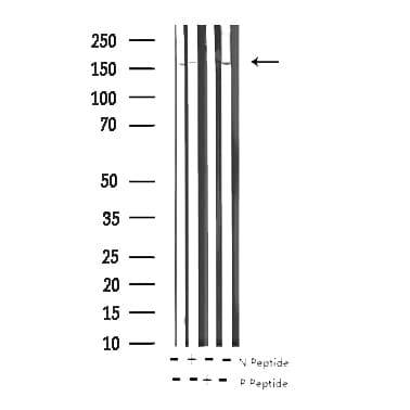 Polyclonal Rabbit anti-Human EGFR Antibody (phospho-Tyr869, IF, WB)