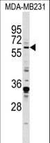 Polyclonal Rabbit anti-Human ZIF268 / EGR1 Antibody (aa9-37, IF, WB)