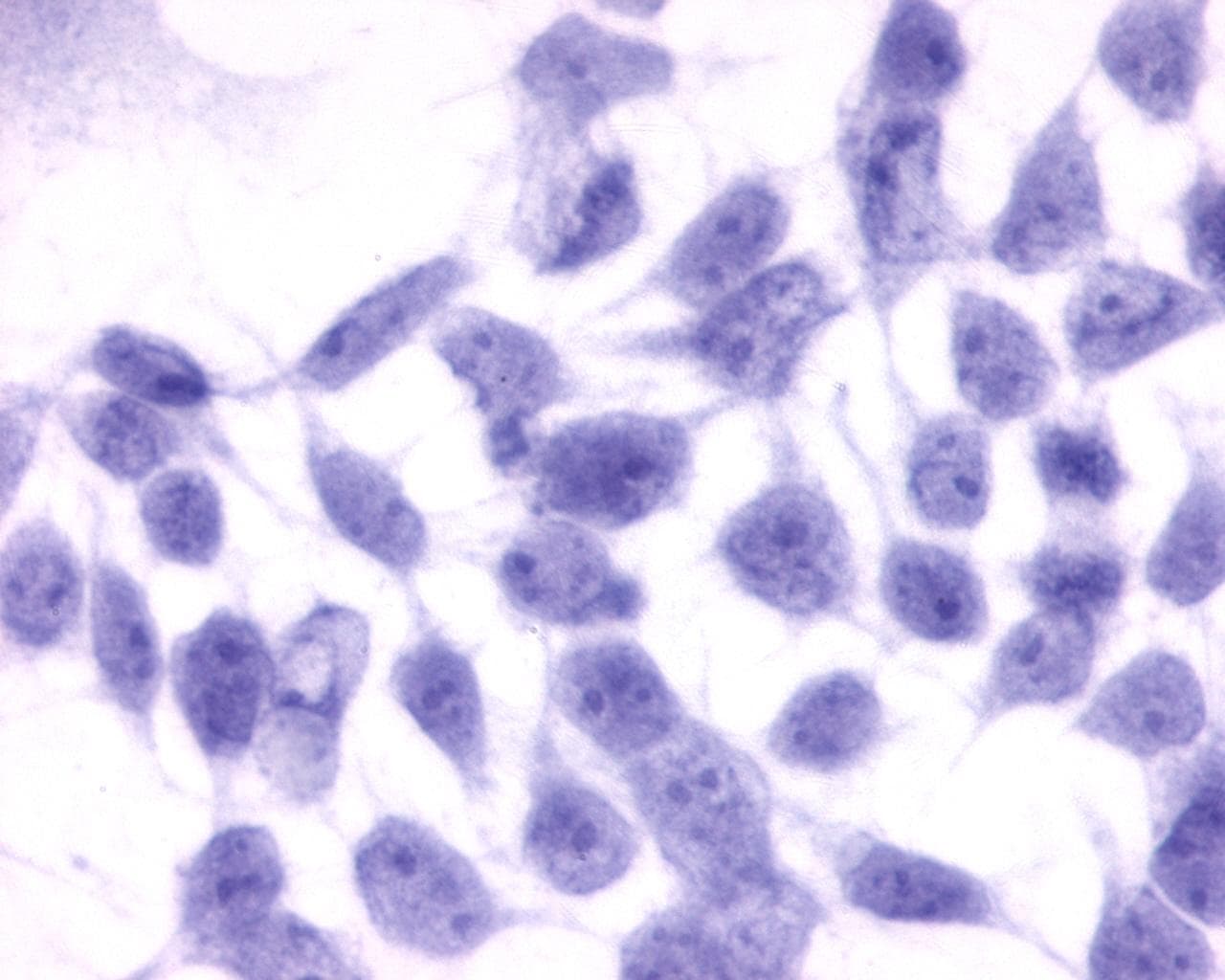 PathPlus™ EDNRB / Endothelin B Receptor Antibody (N-Terminus)