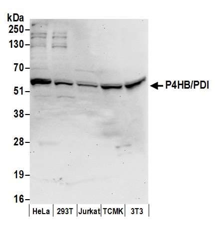 PDI / P4HB Antibody (aa50-100)