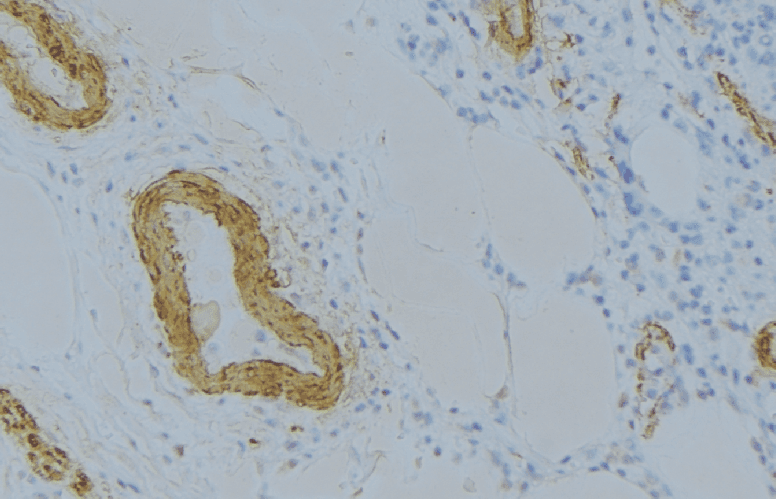 Complement C6 Antibody