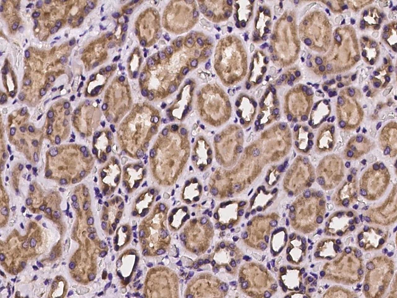 Polyclonal Rabbit anti-Human Dynactin 2 / Dynamitin Antibody (IHC, IF)