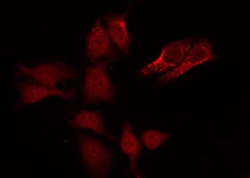 CASP8 / Caspase 8 Antibody (phospho-Ser347)