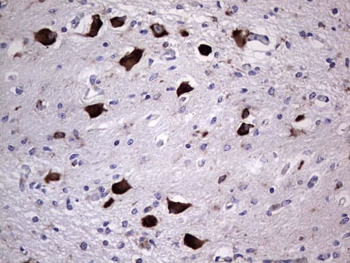 ANO1 / DOG1 / TMEM16A Antibody (aa1-333, clone OTI1C8)