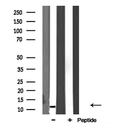 RPL34 / Ribosomal Protein L34 Antibody