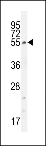 Polyclonal Rabbit anti-Human CCDC61 Antibody (aa36-65, WB)