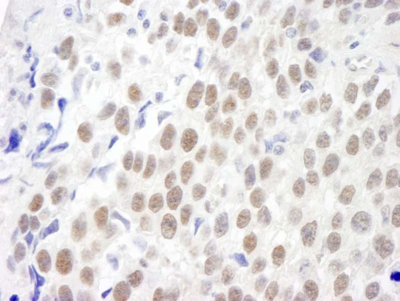 Polyclonal Rabbit anti-Human CMTR1 / FTSJD2 Antibody (aa100-150, IHC)