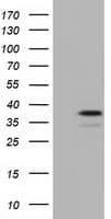 MMS21 / NSMCE2 Antibody (clone OTI3C10)