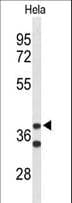 CYTH3 / GRP1 Antibody (aa371-400)
