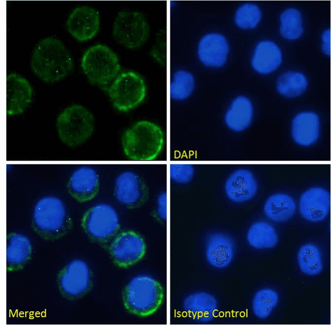 IL6R / IL6 Receptor Antibody (IL-6 receptor, clone rhPM-1 (Tocilizumab))