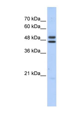 CSA / ERCC8 Antibody (C-Terminus)