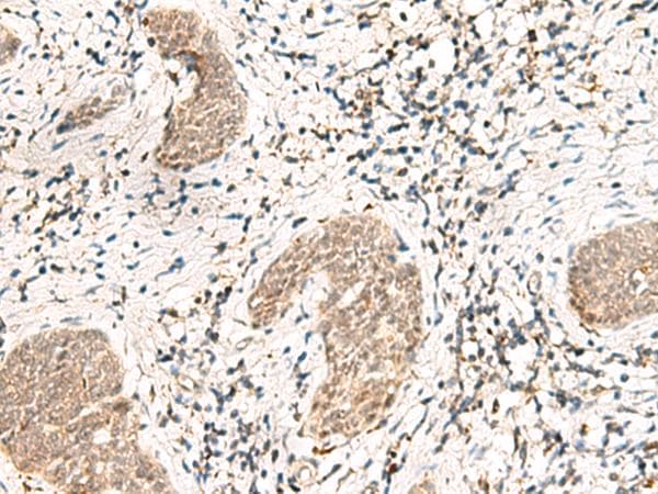 Polyclonal Rabbit anti-Human SNRPG Antibody (IHC)