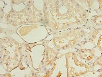 NKIRAS1 Antibody