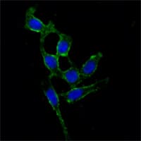 FAK / Focal Adhesion Kinase Antibody (clone 10H7E9)