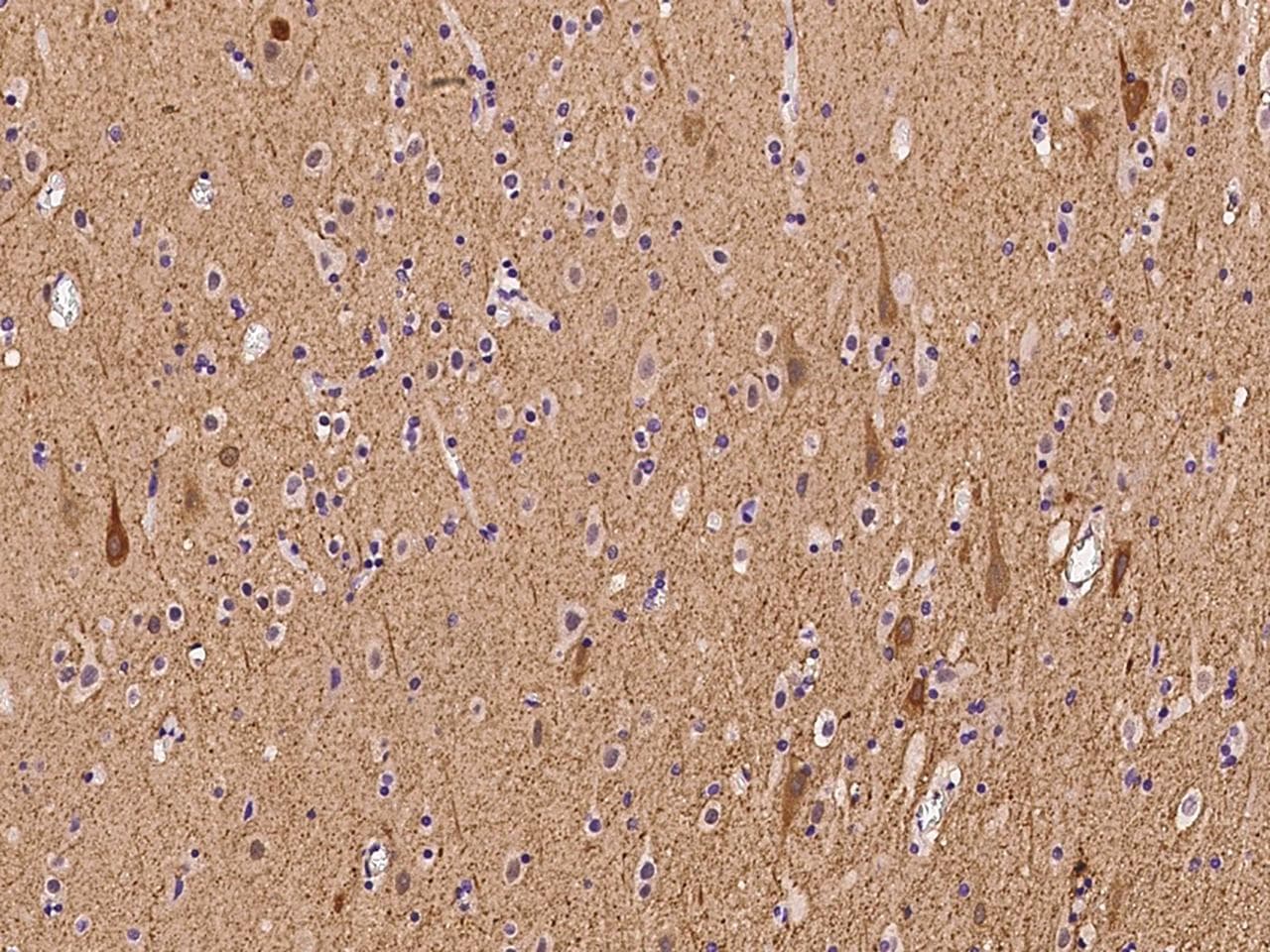 AHNAK2 Antibody