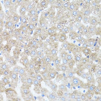 Polyclonal Rabbit anti-Human ARRB1 / Beta Arrestin 1 Antibody (IHC, IF, WB)