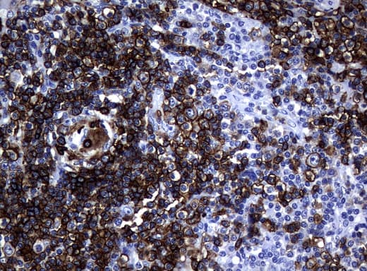 Monoclonal Mouse anti-Human CD20 Antibody (clone UMAB58, IHC, IF, WB)