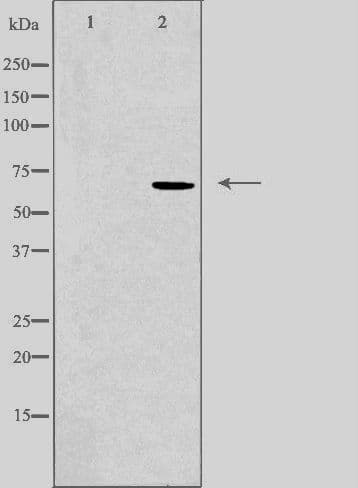 Polyclonal Rabbit anti-Human KCNA5 / Kv1.5 Antibody (IF, WB)