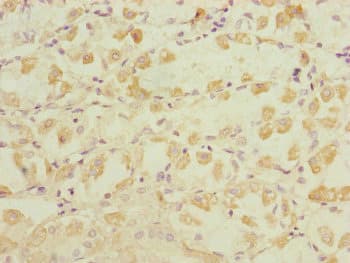 DYNC1I1 Antibody