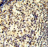 SNRPD1 / SMD1 Antibody (aa69-98)