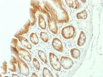CTNNB1 / Beta Catenin Antibody (clone CTNNB1/1507, Azide-free, BSA-free)