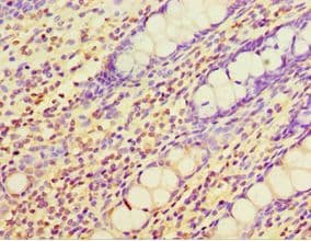 Polyclonal Rabbit anti-Human YKL39 / CHI3L2 Antibody (aa27-390, IHC, WB)