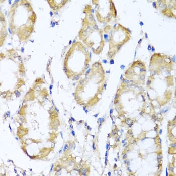 KCND2 / Kv4.2 Antibody
