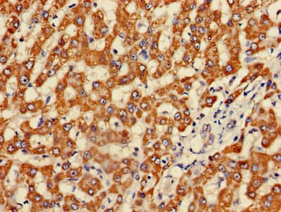FH / Fumarase / MCL Antibody