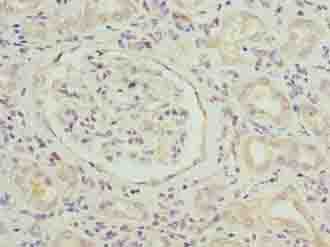 SLITRK4 Antibody