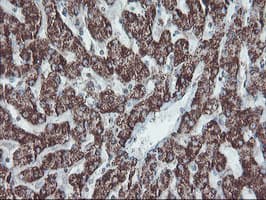 Monoclonal Mouse anti-Human SKIL / SNO / SnoN Antibody (clone OTI3E2, IHC, WB)