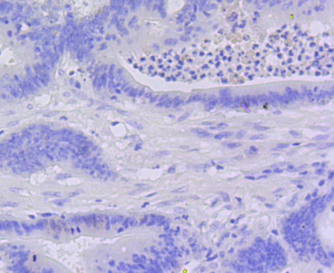 CASP3 / Caspase 3 Antibody