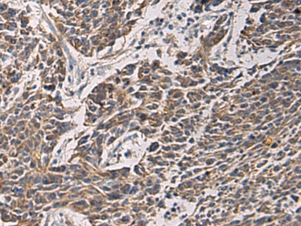 Polyclonal Rabbit anti-Human MAPKAPK3 Antibody (IHC)
