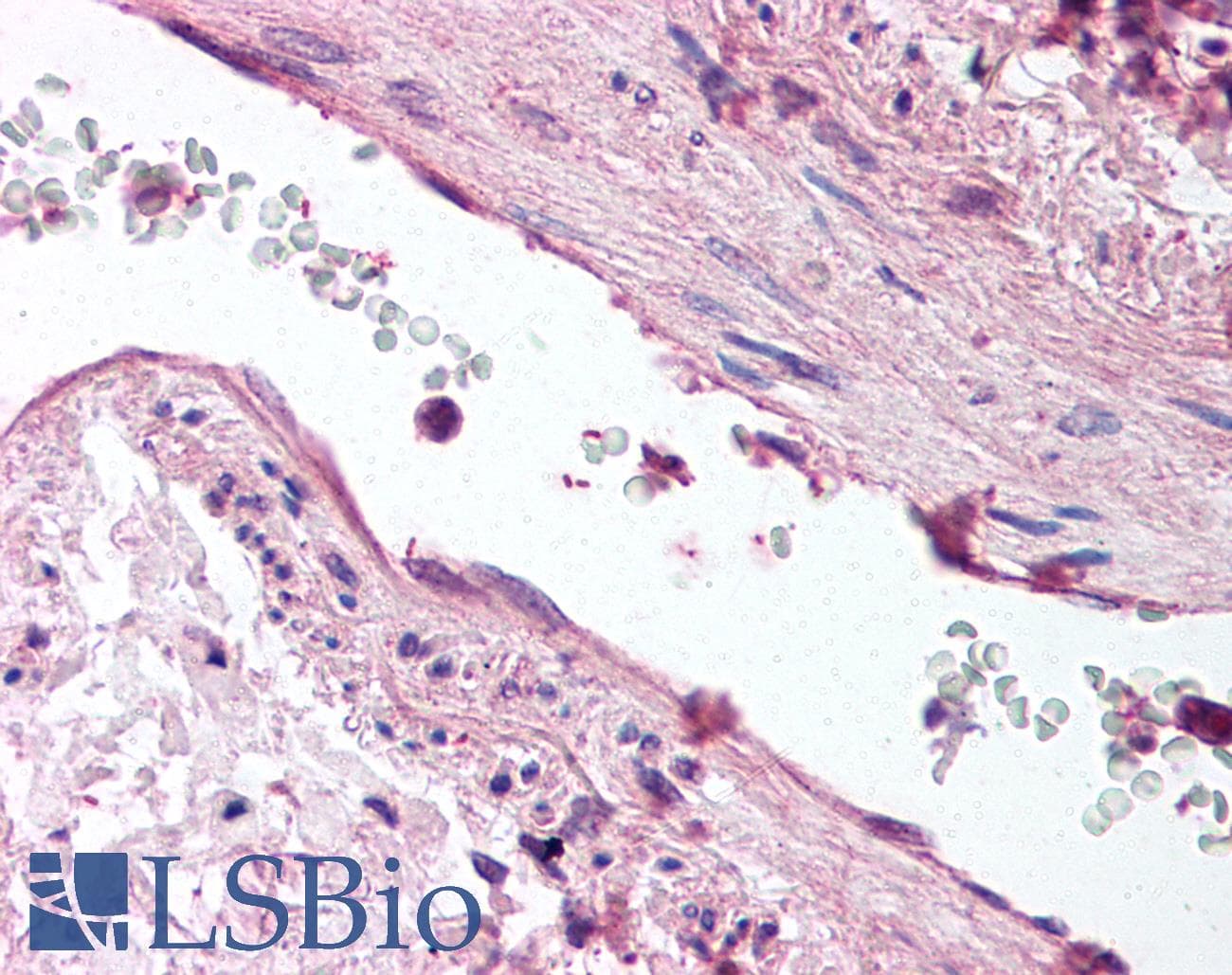 IHC-plus™ Polyclonal Rabbit anti-Mouse ANGPT1 / Angiopoietin-1 Antibody (aa15-45, IHC, WB)
