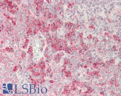 KLRD1 / CD94 Antibody (aa61-110)