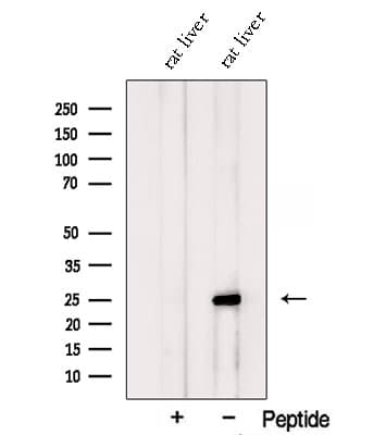 PSPH Antibody