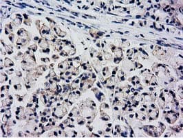 KCTD14 Antibody (clone OTI1D11)