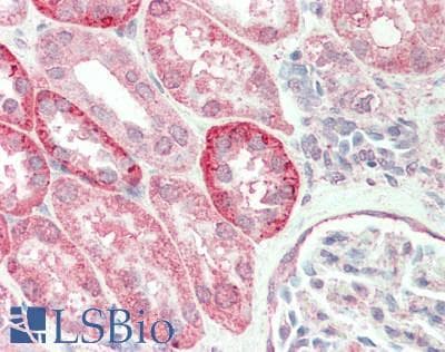 Polyclonal Rabbit anti-Human LETMD1 / HCCR1 Antibody (aa271-320, IHC, WB)
