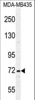 SRBD1 Antibody (aa934-963)