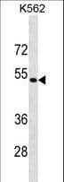 Polyclonal Rabbit anti-Human PSMD4 / RPN10 Antibody (aa300-328, WB)