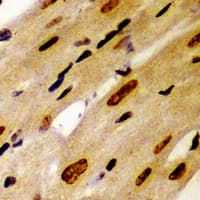 PSMC2 / RPT1 Antibody