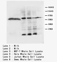 LPL / Lipoprotein Lipase Antibody (C-Terminus)