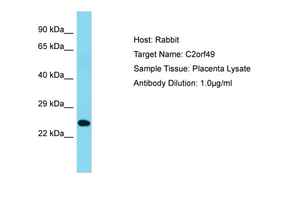 C2orf49 Antibody (aa93-142)
